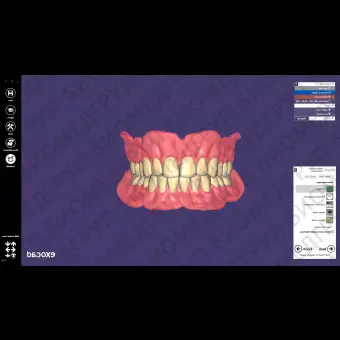 Exocad Full Denture Module  модуль для создания полносъемных протезов