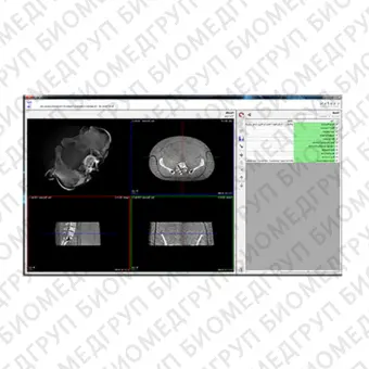 Программное обеспечение для медицинских снимков CBCT