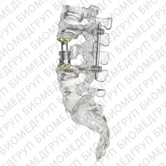 Позвоночный протез для грудопоясничной зоны obelisc