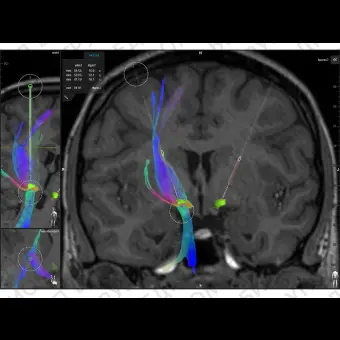 Клиническое программное обеспечение Brainlab Elements