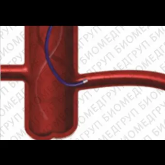 Катетер для ангиографии GRAFIA