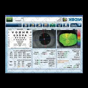 Роговичный топограф OPDSCAN III