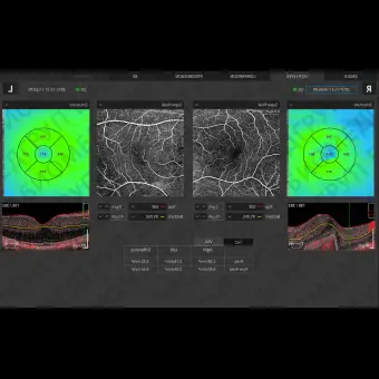 Офтальмоскоп ОКТ REVO NX 130