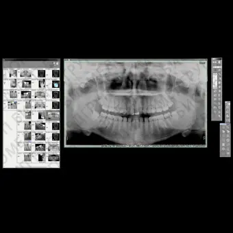 Программное обеспечение для обработки снимков зубов Quickvision