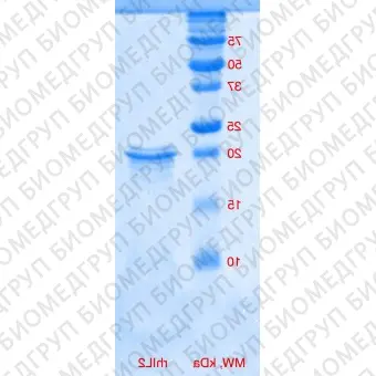 Интерлейкин 2 человека, рекомбинантный белок, rhIL2, Россия, PSG21010, 10 мкг