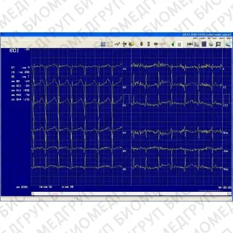 Скрининговый аудиометр PDD702