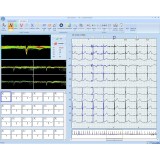 Программное обеспечение для холтеровского монитора EUROHOLTER SW3/12