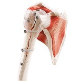 Ортопедическая проволока для контроля протеза бедра Strapflex