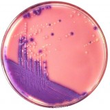 Escherichia coli