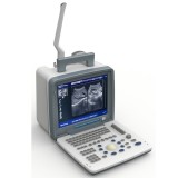 Переносной ультразвуковой сканер DP-6800
